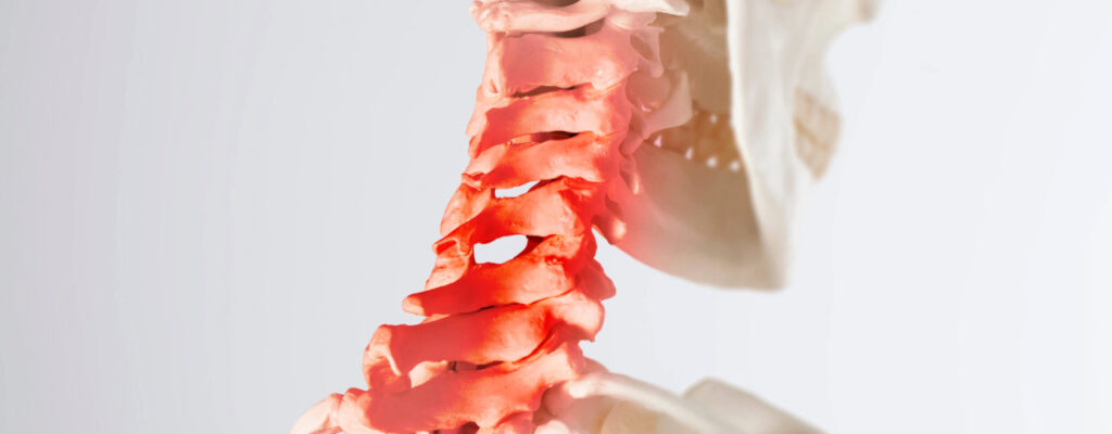 Whiplash_Treatment_Managing_Neck_Injuries_After_a_Car_Accident